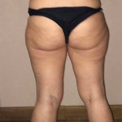 Dopo il trattamento estetico