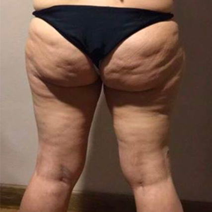 Prima del trattamento