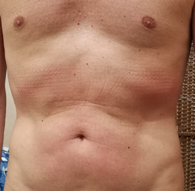 Prima del trattamento