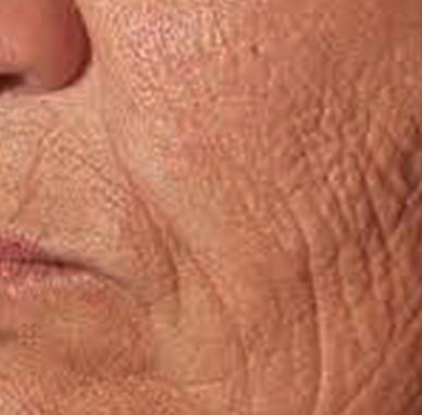 Prima del trattamento