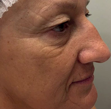 Prima del trattamento