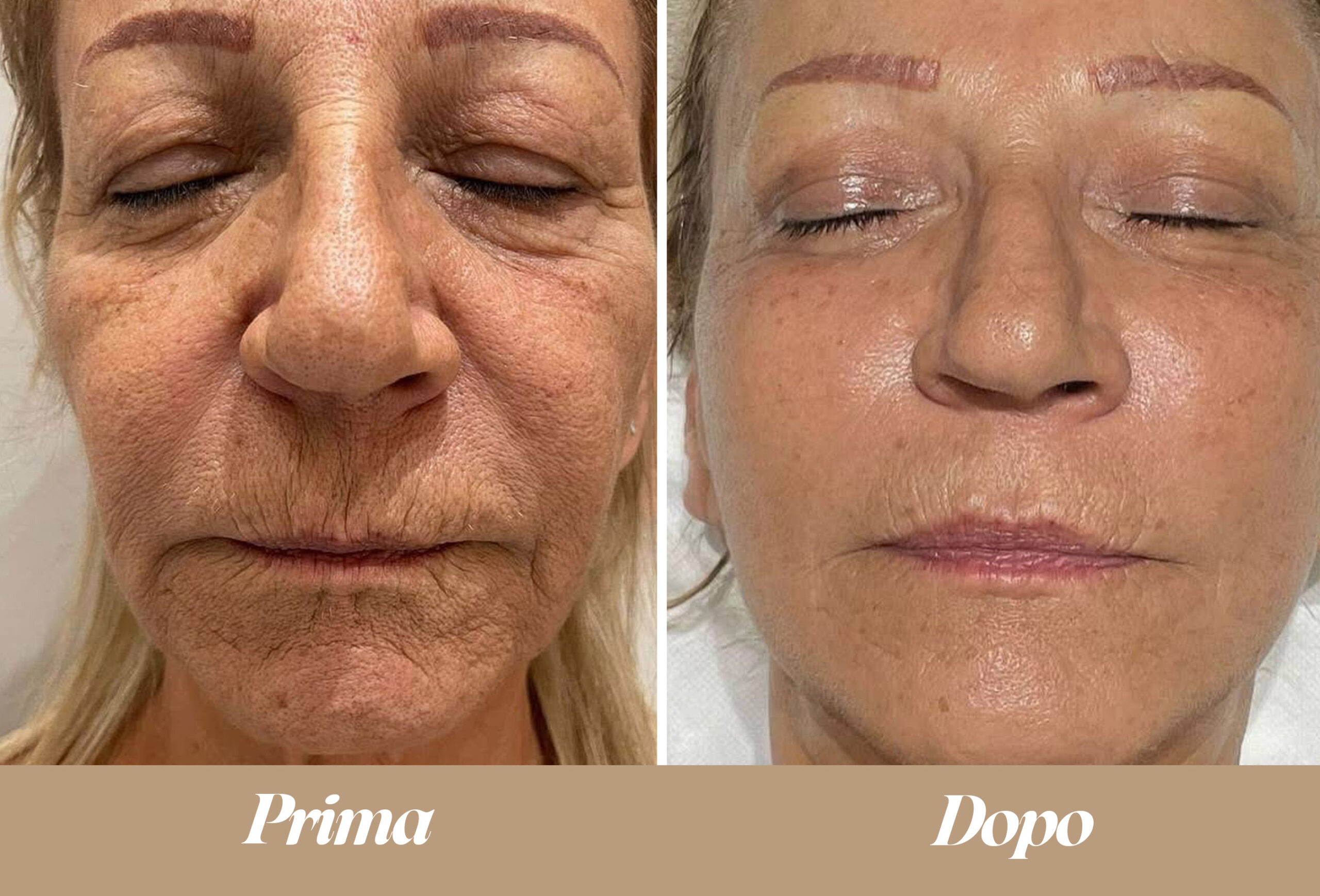 Onda Dinamica Viso